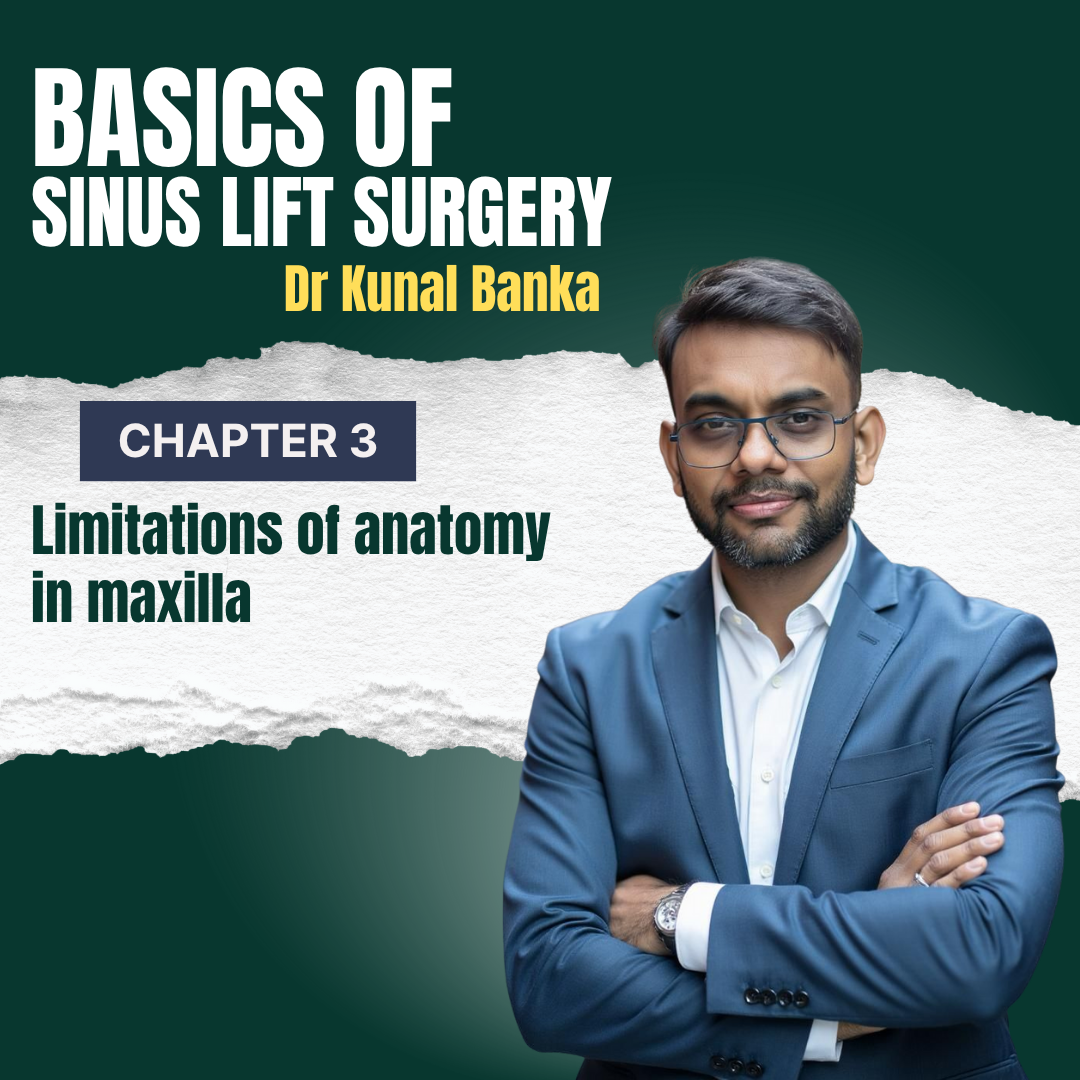 Basics Of Sinus Lift For Beginners