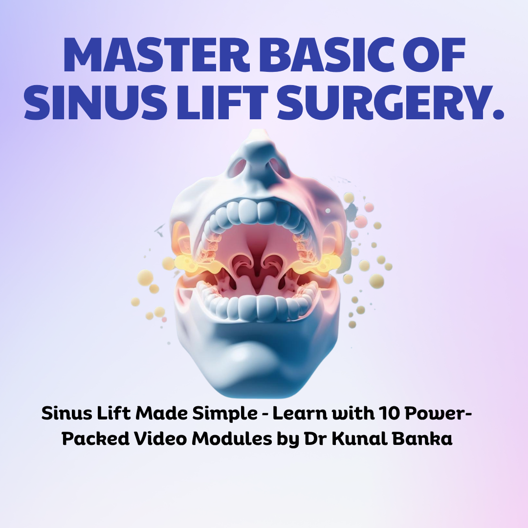 Basics Of Sinus Lift For Beginners